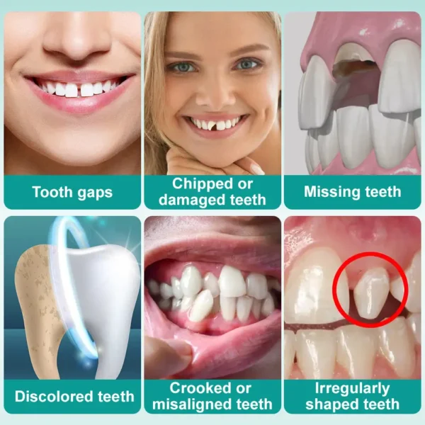 🦷𝗢𝘂𝗿𝗹𝘆𝗮𝗿𝗱® 𝗜𝗻𝘀𝘁𝗮𝗻𝘁 𝗦𝘁𝗶𝗰𝗸-𝗼𝗻 𝗗𝗲𝗻𝘁𝗮𝗹 𝗩𝗲𝗻𝗲𝗲𝗿𝘀 (✅Clinically proven, easy-to-use dental veneers trusted by over 8,000 US users for a comfortable, natural smile.)