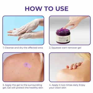 ✅ Official Store: Medazy™ Clarivine Dissolver Mole & Dark Spot Removal Bio-Gel