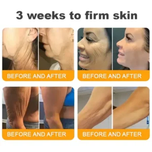 ✨ Radiant, Firm & Supple ✨ TAILEDEN® Bee Venom Skin Renewal Cream – Proudly Made in USA