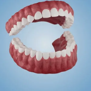 AQA™-New Generation Flexible Full Denture Solution