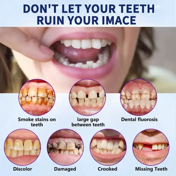 AQA™-New Generation Flexible Full Denture Solution