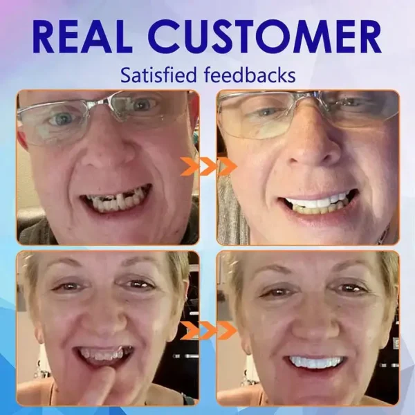 AQA™-New Generation Flexible Full Denture Solution