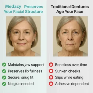 Medazy™ Custom-Fit Full Functional Dentures