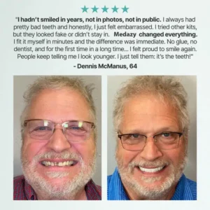 Medazy™ Custom-Fit Full Functional Dentures