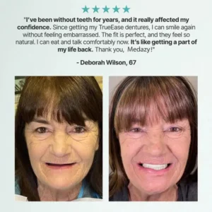 Medazy™ Custom-Fit Full Functional Dentures