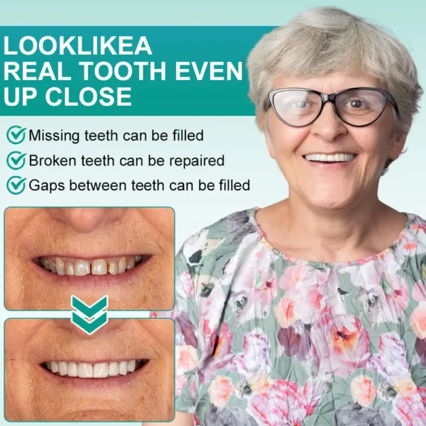 🦷Medazy® Instant Stick-on Dental Veneers (✅Clinically proven, easy-to-use dental veneers trusted by over 8,000 US users for a comfortable, natural smile.)