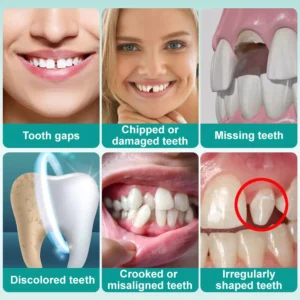 🦷Medazy® Instant Stick-on Dental Veneers (✅Clinically proven, easy-to-use dental veneers trusted by over 8,000 US users for a comfortable, natural smile.)