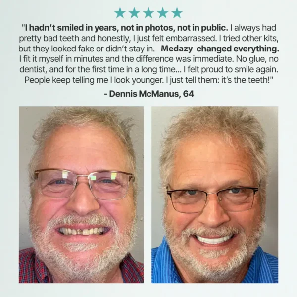【OFFICIAL STORE】Medazy™ Custom-Fit Full Functional Dentures