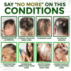 Medazy® Microneedle Herbal Infusion Hair Stimulation Set