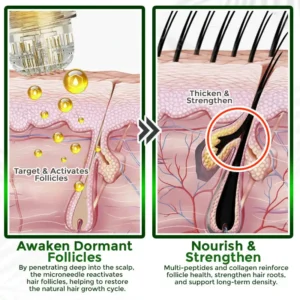 Medazy® Microneedle Herbal Infusion Hair Stimulation Set
