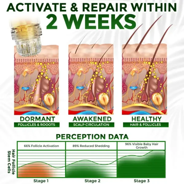 Medazy® Microneedle Herbal Infusion Hair Stimulation Set