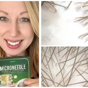 Medazy® Microneedle Herbal Infusion Hair Stimulation Set